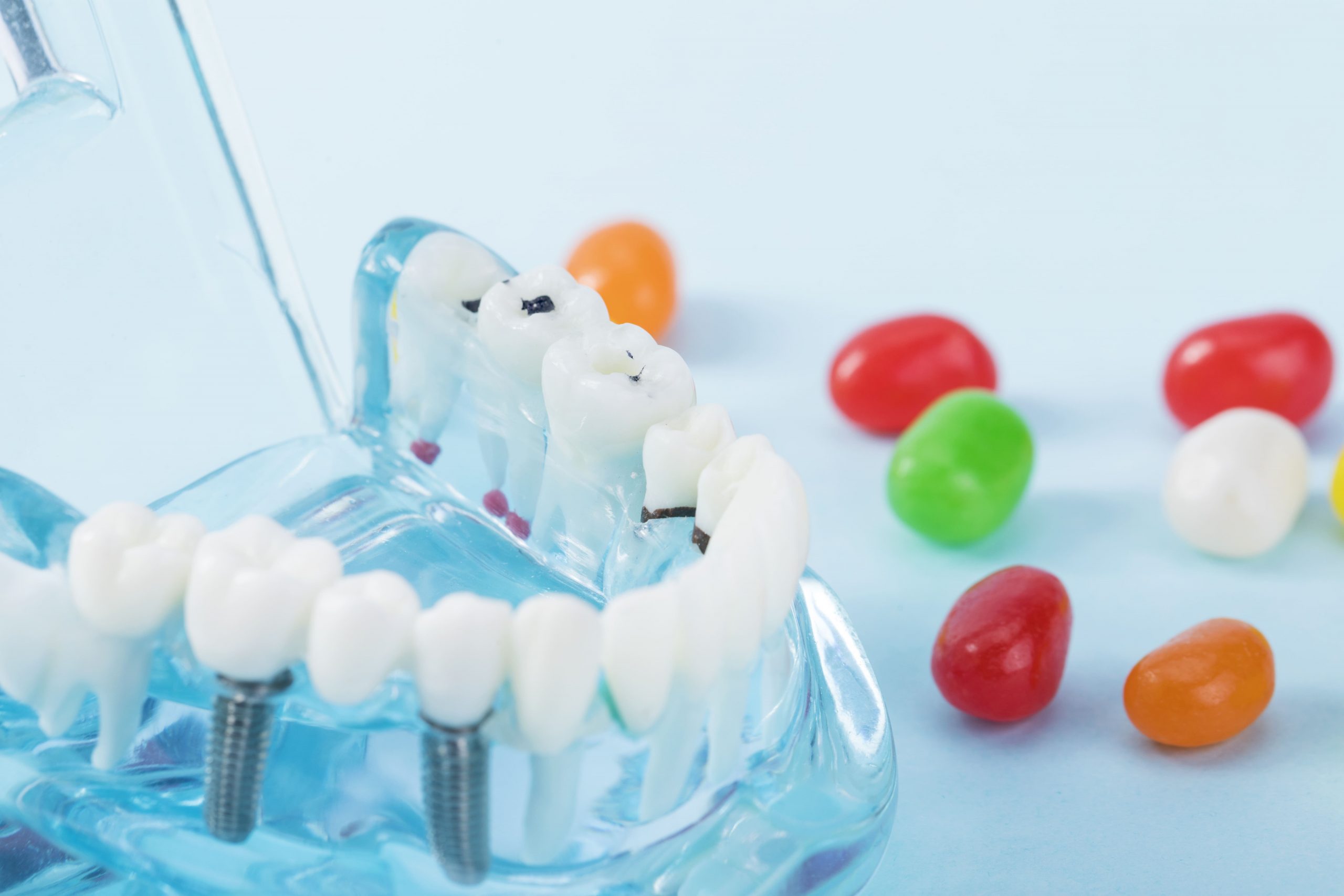 想植牙該如何選擇信任又安心的牙醫診所